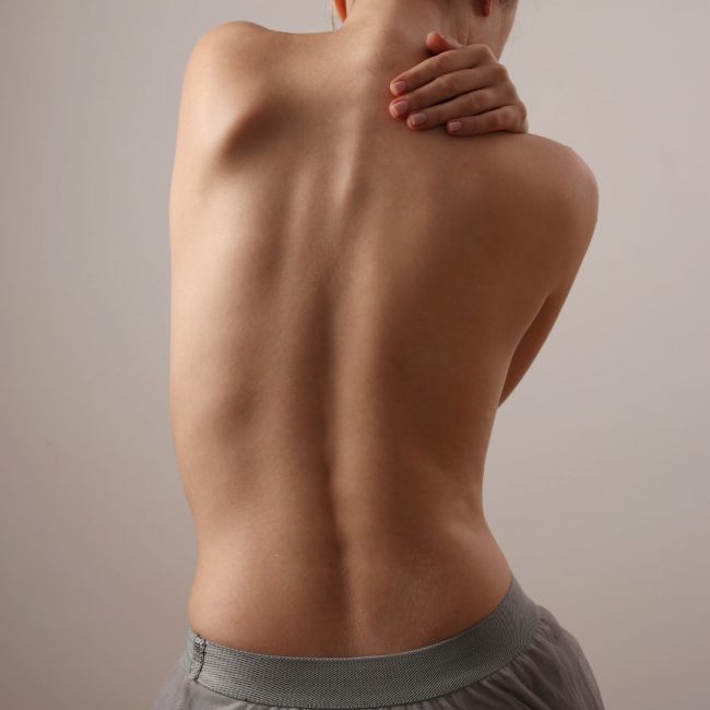 escoliosis